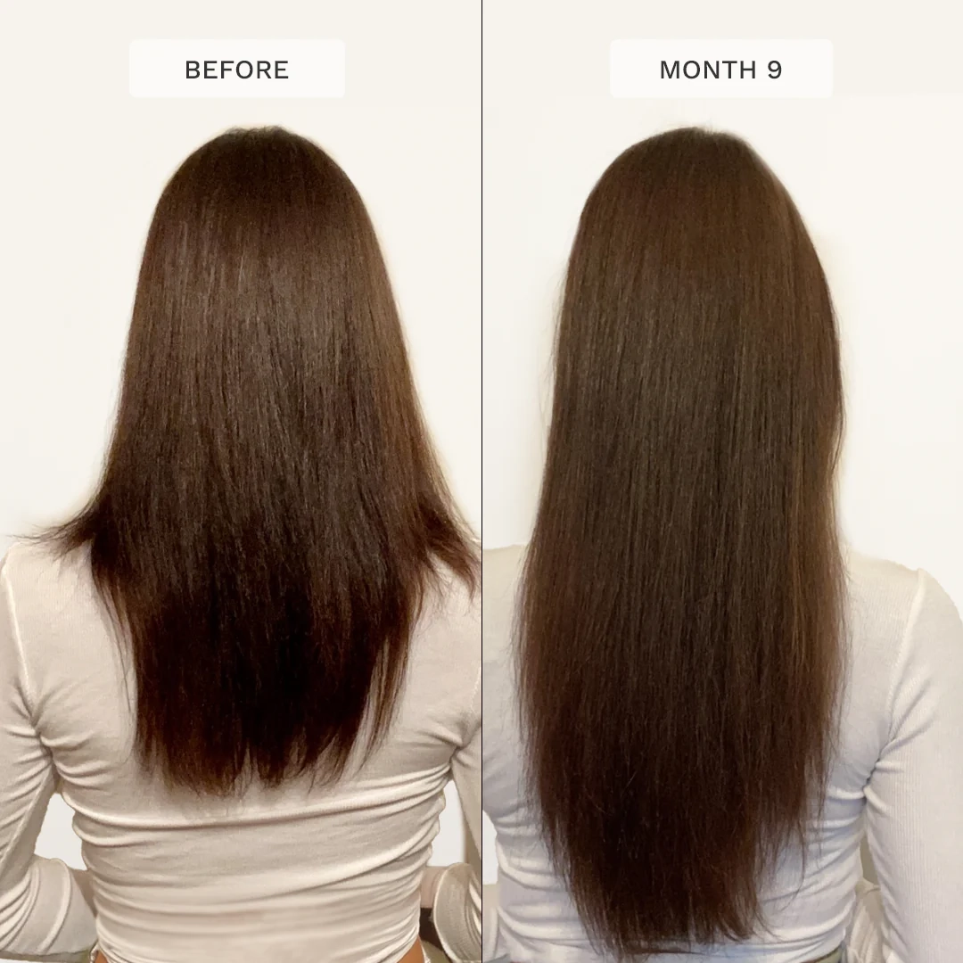 شامپو و نرم کننده تقویت کننده هیربرست | Hairburst Shampoo & Conditioner for Longer, Stronger Hair اورجینال را میتوانید از بهارشاپ بیوتی (BaharShopBeauty.ir) تهیه کنید.