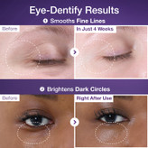 کرم دور چشم نامبوزین