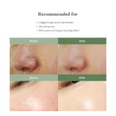 پاک کننده و کنترل کننده چربی پریمیوم کوئیک استپ دکتر التیا