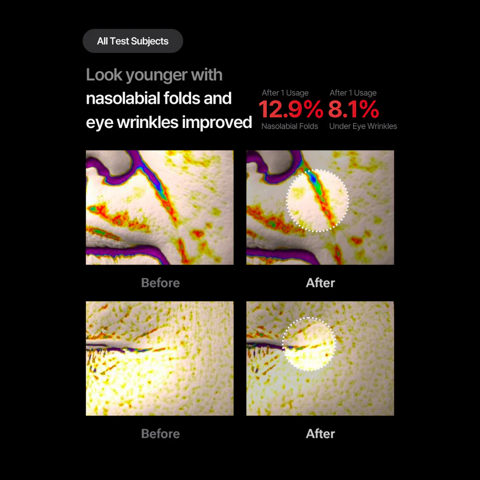 دستگاه جوانساز و لیفتینگ + کرم لیفتینگ شوماژ گلد سیل مدی تراپی