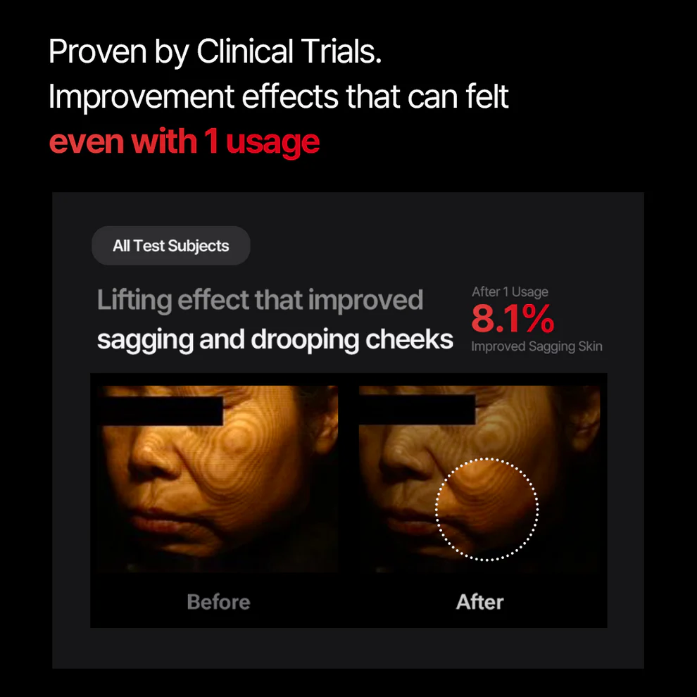 دستگاه جوانساز و لیفتینگ + کرم لیفتینگ شوماژ گلد سیل مدی تراپی