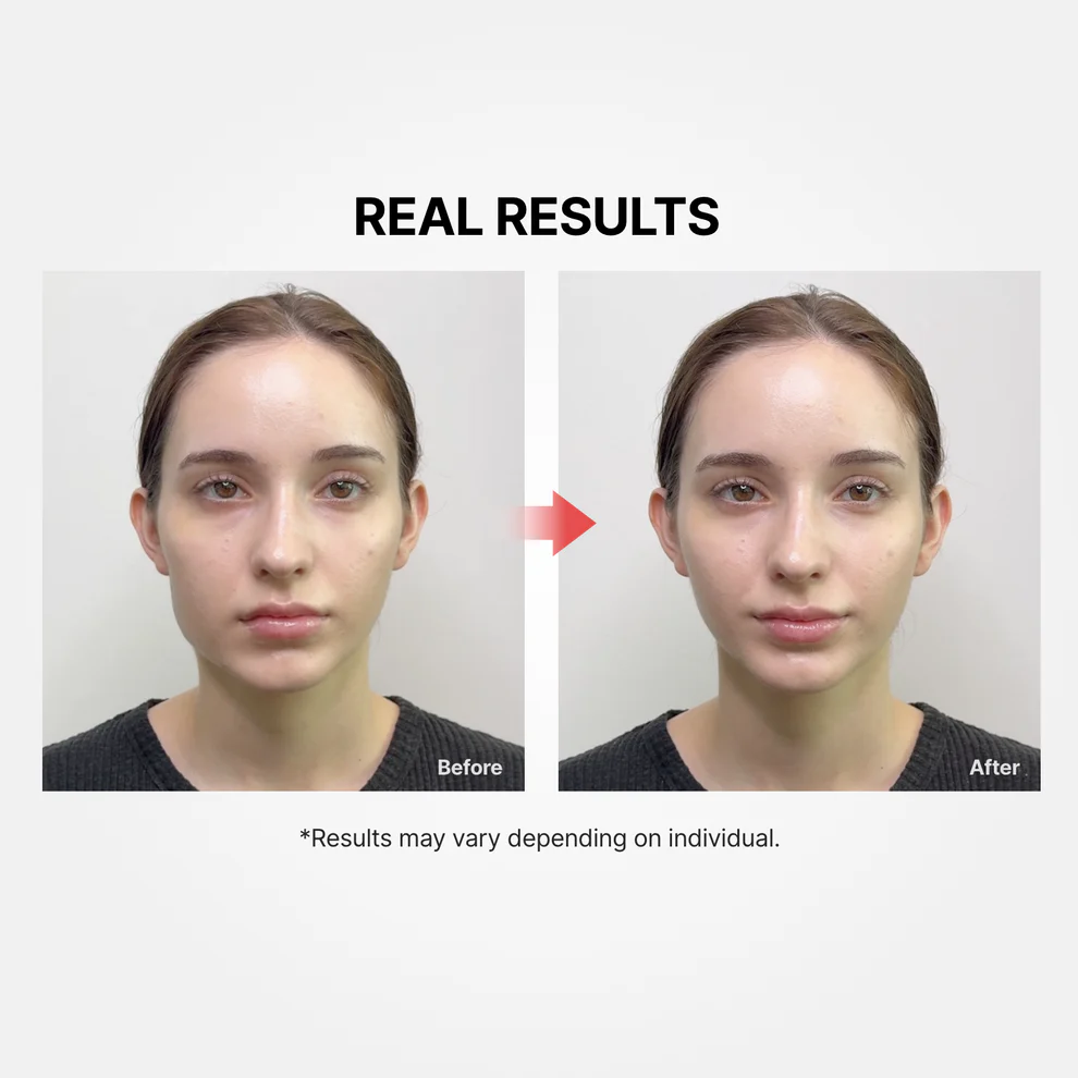 دستگاه جوانساز و لیفتینگ + کرم لیفتینگ شوماژ گلد سیل مدی تراپی