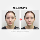 دستگاه جوانساز و لیفتینگ + کرم لیفتینگ شوماژ گلد سیل مدی تراپی